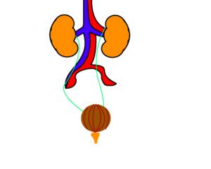 excretory-system-diseases-4